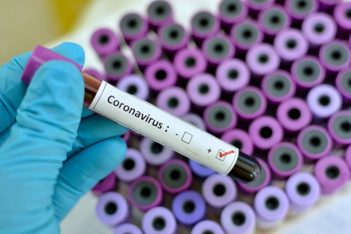 ERE temporal debido al Coronavirus